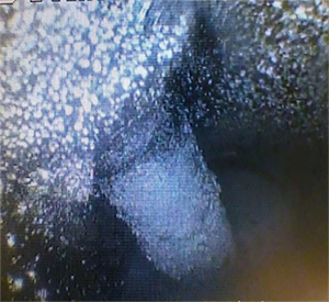 黑不溜秋的還有粉末狀，好惡心~  